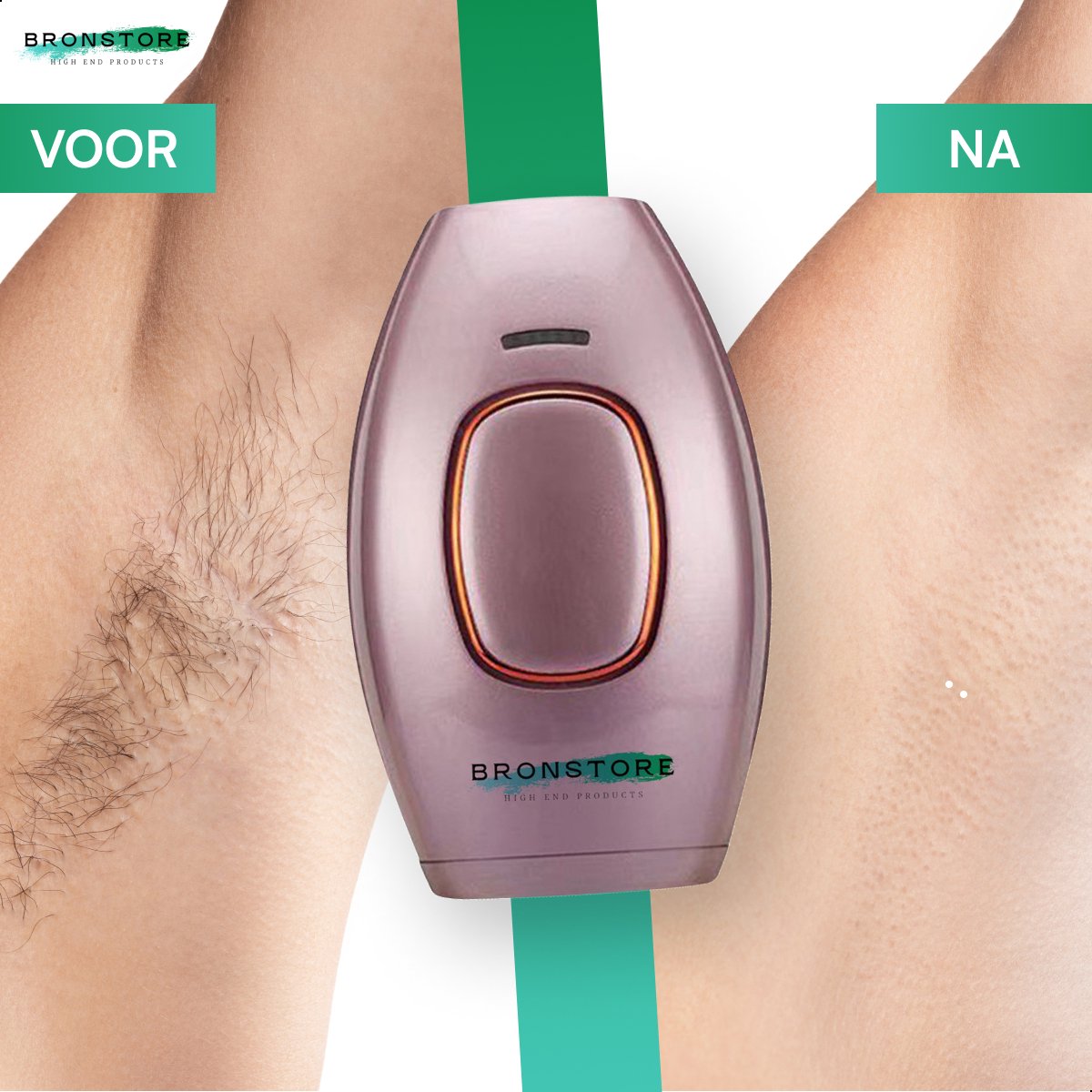 BronStore® Laser Ontharingsapparaat - Twenty4seven®